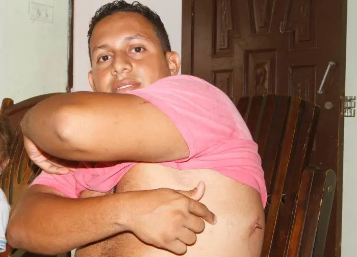 vidrio dentro de la piel - Cómo saber si tengo un vidrio debajo de la piel