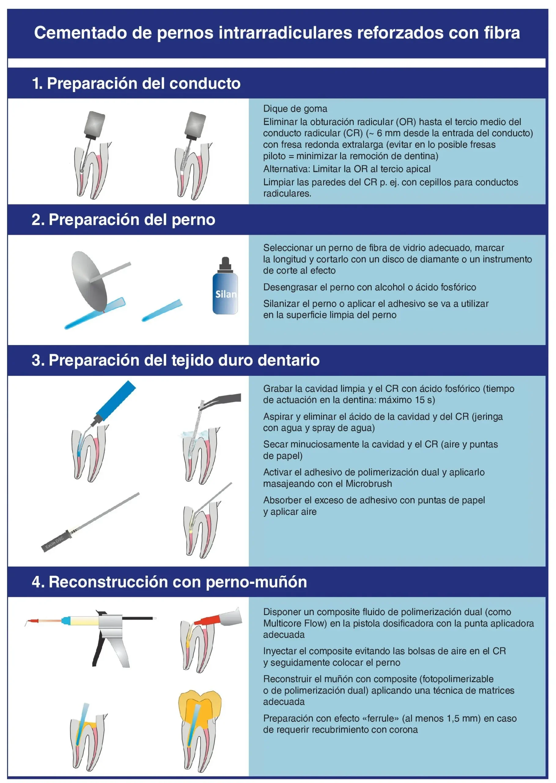 colocacion de pernos de fibra de vidrio - Qué tornillo usar para fibra de vidrio